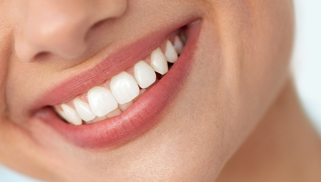 Closeup of perfect smile with porcelain veneers