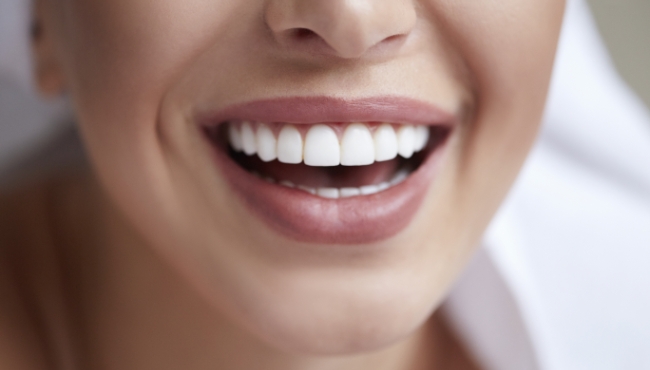 Closeup of perfect smile after dental implant tooth replacement