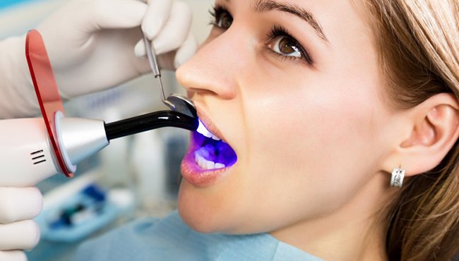 woman getting direct bonding 
