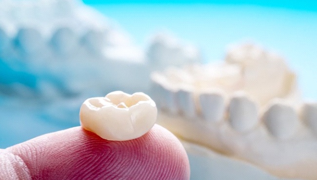 dentist in Fort Worth holding a dental crown on their finger