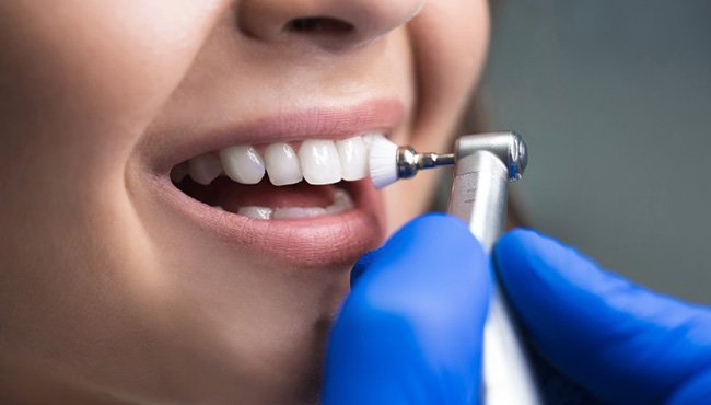 Dentist applying fluoride to a patient’s teeth