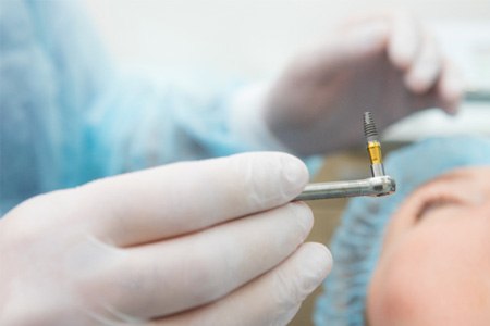 dentist holding dental implant