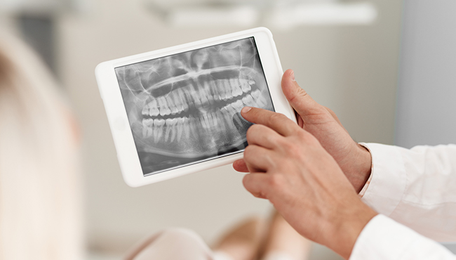 Digital x-rays on tablet computer