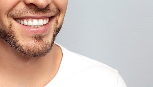 Closeup of man after teeth whitening in Fort Worth