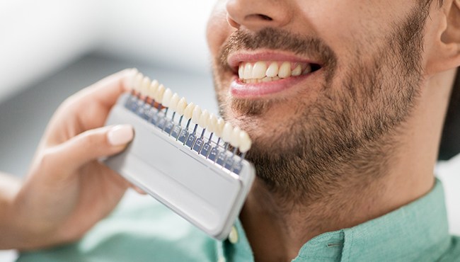 Dentist holding up veneer shades to patients smile