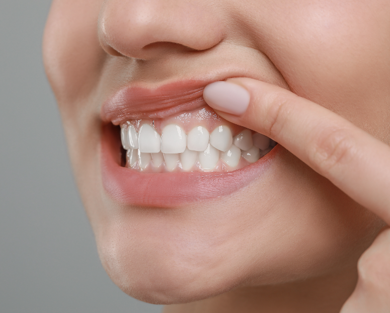 Close up of woman's gums
